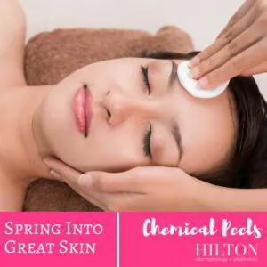 chemical peels in spring 300x300 4042627