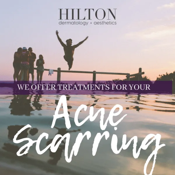Copy of PREVENT ACNE SCARRING 600x600 4000118