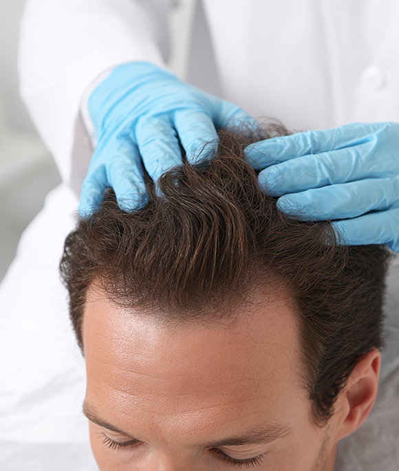 HAIR RESTORATION